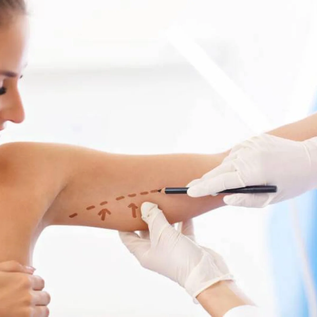 Dr Mikael Nicolai Chirurgien Esthetique Marseille Chirurgie De La Peau De La Face Interne Des Bras