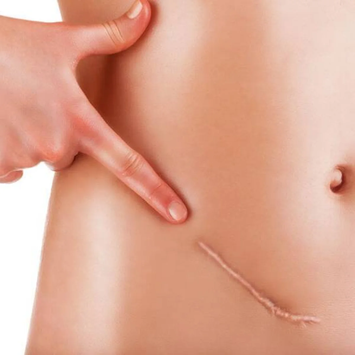 Dr Mikael Nicolai Chirurgien Esthetique Marseille Chirurgie Reparatrice Des Cicatrices 1