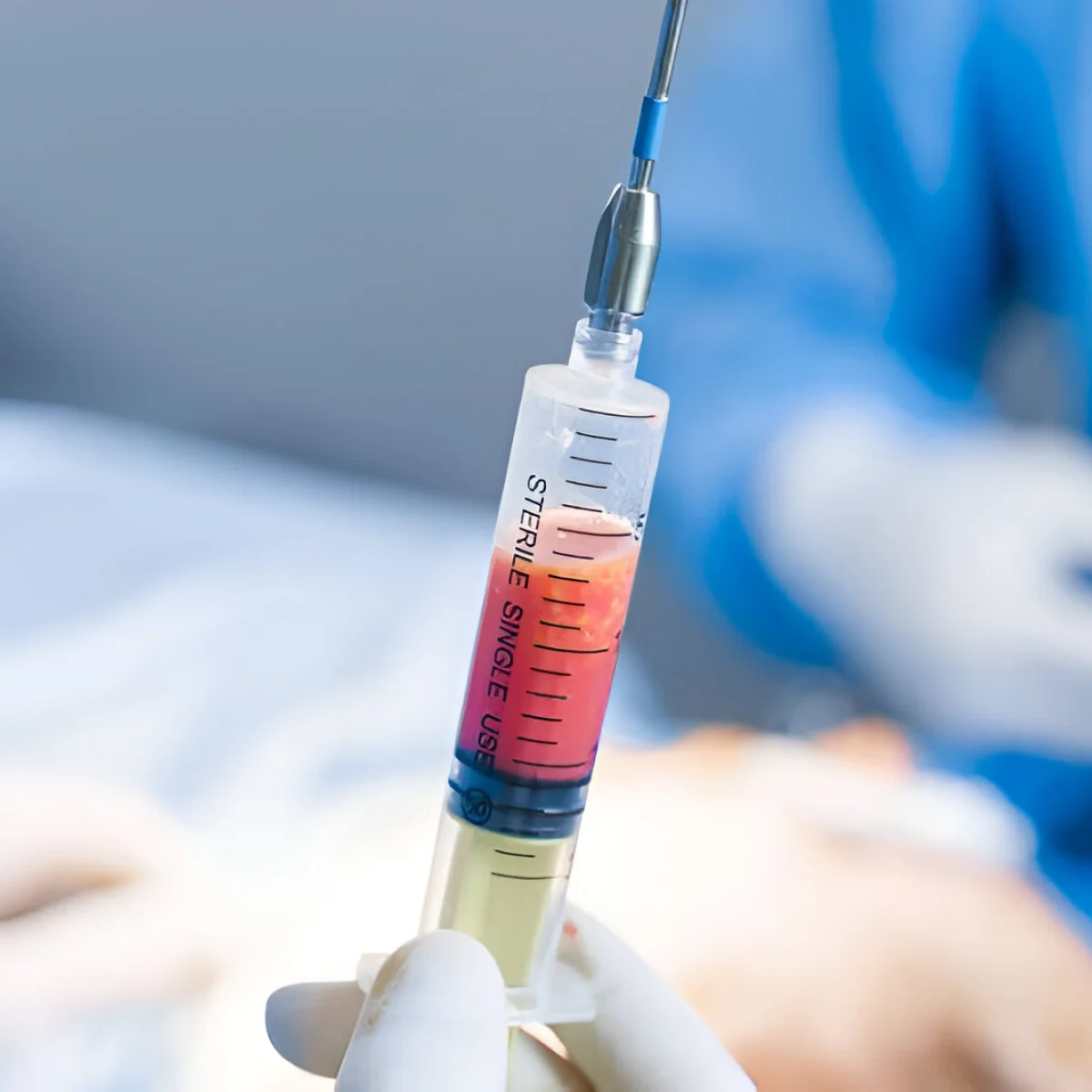 Dr Mikael Nicolai Chirurgien Esthetique Marseille Injection De Graisse