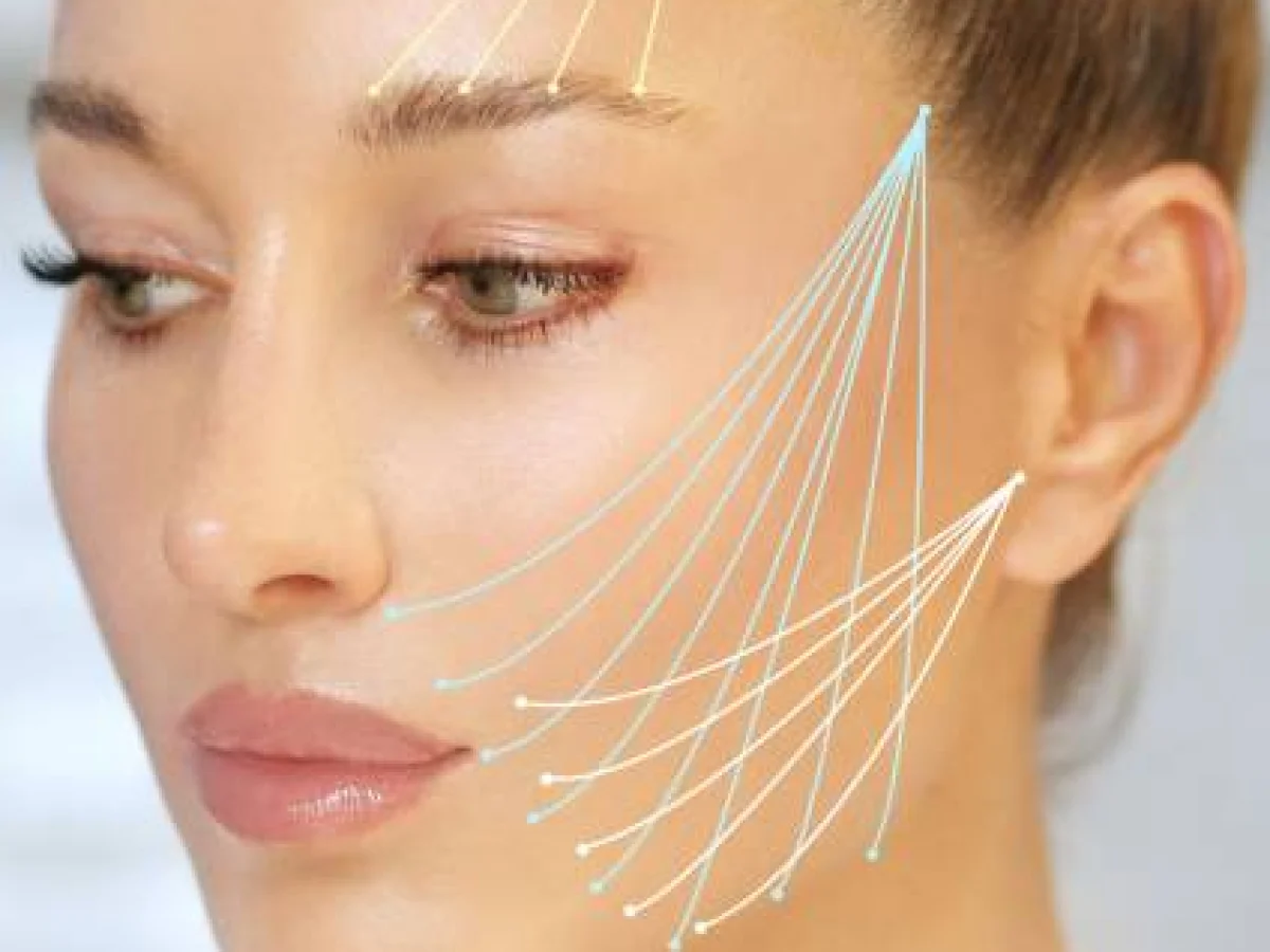 Dr Mikael Nicolai Chirurgien Esthetique Marseille Le Rajeunissement Du Visage Par Fils Tenseurs