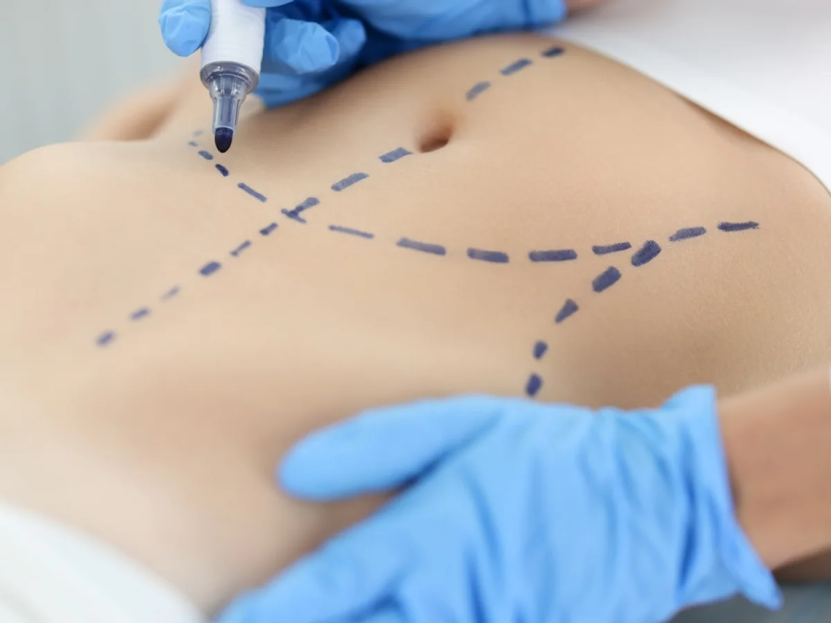 Médecine esthétique et chirurgie réparatrice à Apt