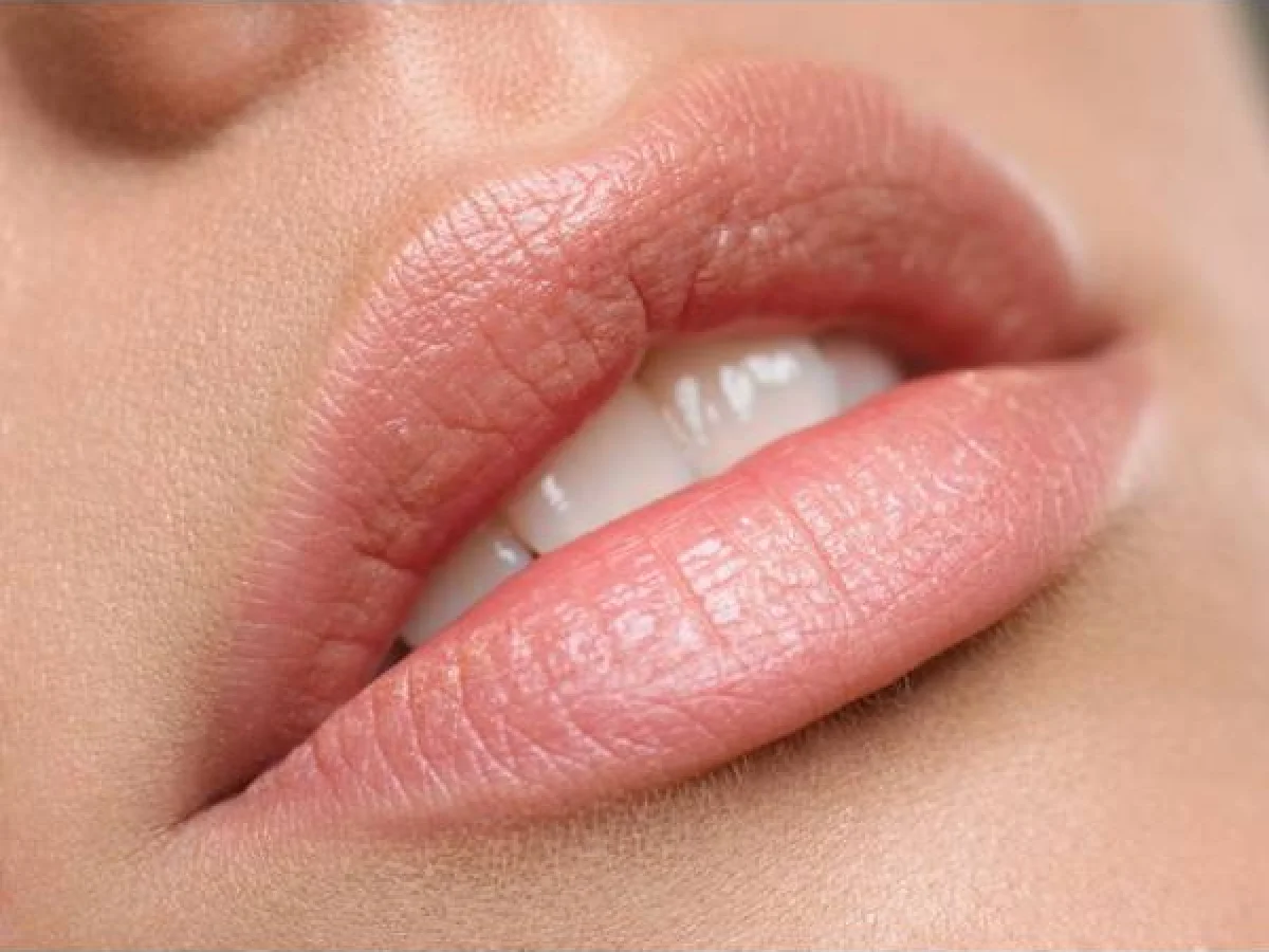 Dr Mikael Nicolai Chirurgien Esthetique Marseille Les Risques Lies A Ces Injections